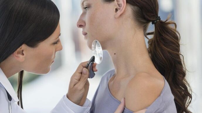 el médico determina el tipo de papiloma en el cuello